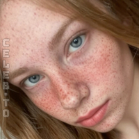 Аляскафреклс Аляскафон Оголені