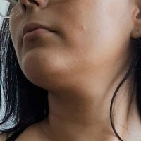 ванелішіос Оголені